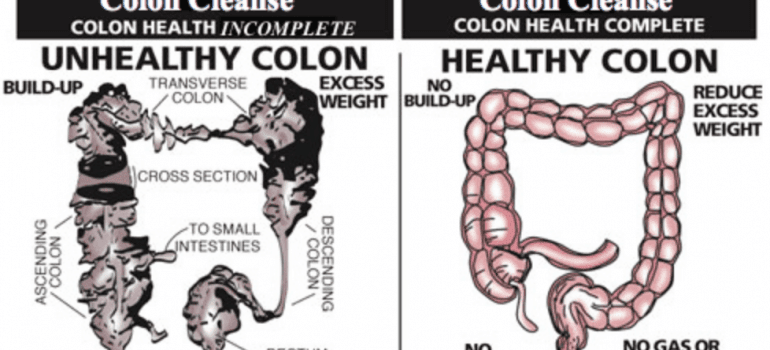 5 Reasons To Think Twice About That Colon Cleanse