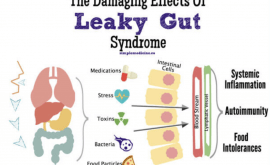 Do you have Leaky Gut Syndrome?